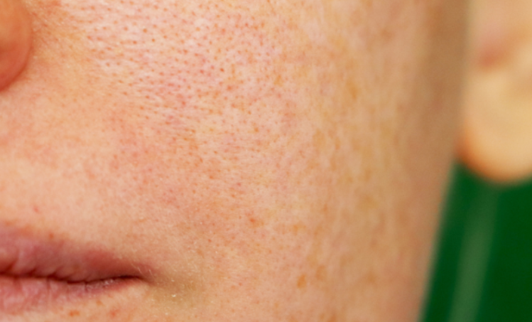 Best Dermatologist Clinic in Noida